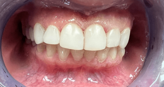OMS-Dental-Before-After-1.png OMS-Dental-Before-After-1.png