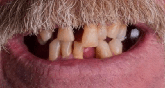 OMS-Dental-Before-After-4.png OMS-Dental-Before-After-4.png