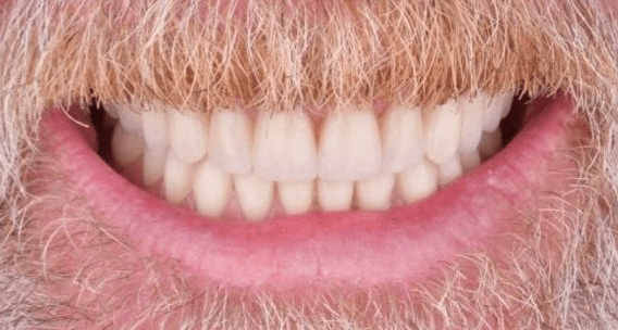 OMS-Dental-Before-After-5.png OMS-Dental-Before-After-5.png