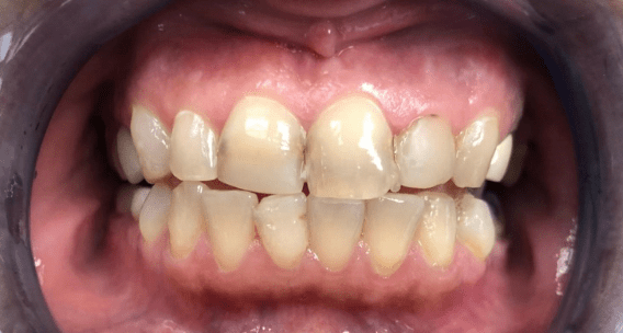 OMS-Dental-Before-After.png OMS-Dental-Before-After.png